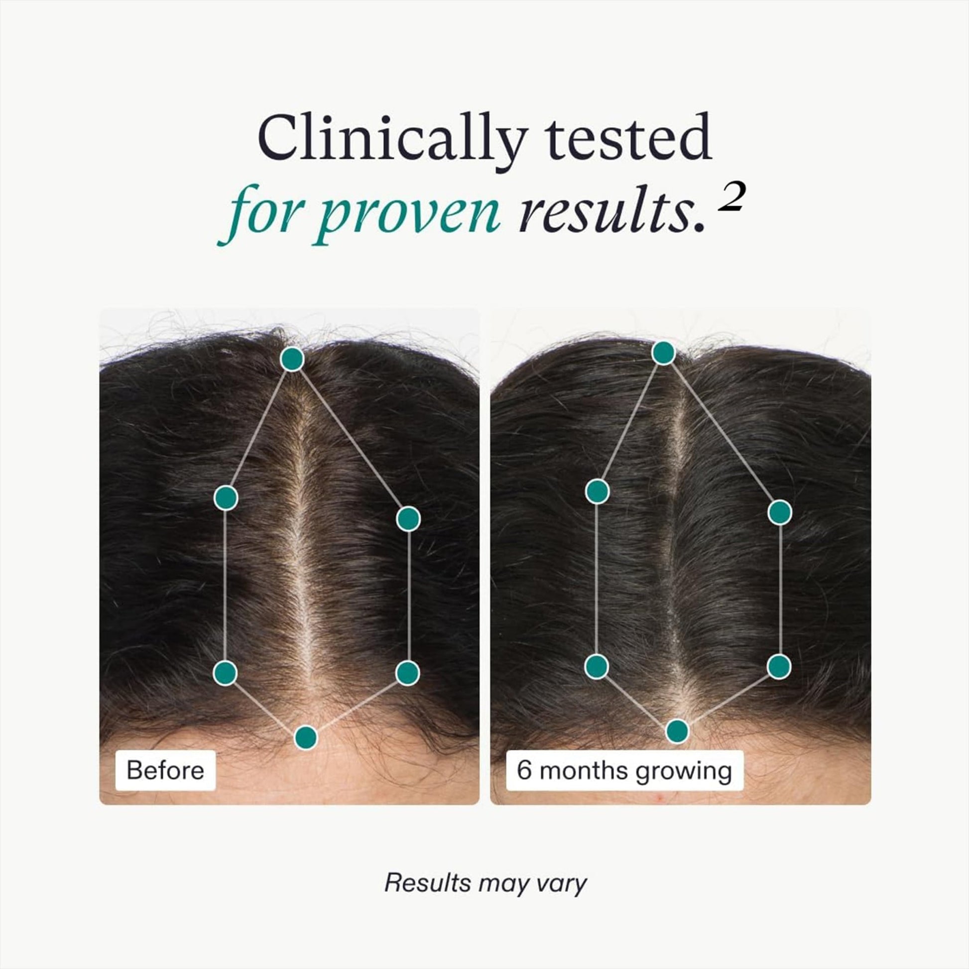 Nutrafol Women's Hair Growth Supplements, Ages 18 - 44, Clinically Proven for Visibly Thicker and Stronger Hair, Dermatologist Recommended - 1 Month Supply - Taylor K Shop